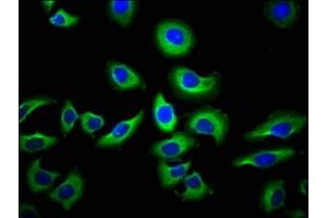 Immunofluorescence staining of A549 cells with ABIN7145194 at 1:66, counter-stained with DAPI. (NAIP anticorps  (AA 147-242))