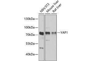 Western blot analysis of extracts of various cell lines, using Y antibody (ABIN6132789, ABIN6150317, ABIN6150322 and ABIN6215136) at 1:1000 dilution. (YAP1 anticorps  (AA 155-504))