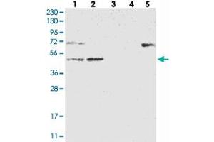 Western blot analysis of Lane 1: RT-4, Lane 2: U-251 MG, Lane 3: Human Plasma, Lane 4: Liver, Lane 5: Tonsil with NT5DC1 polyclonal antibody . (NT5DC1 anticorps)