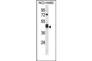 Western blot analysis of IDH3G Antibody (C-term) in NCI-H460 cell line lysates (35ug/lane). (IDH3G anticorps  (C-Term))
