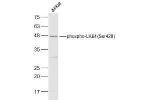 Jurkat lysates probed with LKB1(Ser428) Polyclonal Antibody, Unconjugated  at 1:500 dilution and 4˚C overnight incubation.