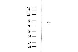 anti-Interleukin 1 Receptor Accessory Protein (IL1RAP) (C-Term) antibody