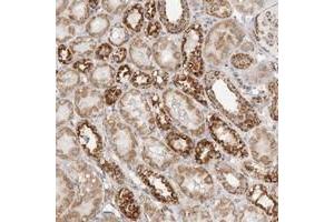 Immunohistochemical staining of human kidney with SLC25A26 polyclonal antibody  shows strong granular cytoplasmic positivity in tubular cells. (SLC25A26 anticorps)