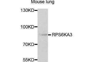 Western blot analysis of extracts of mouse lung, using RPS6KA3 antibody (ABIN5973157) at 1/1000 dilution. (RPS6KA3 anticorps)