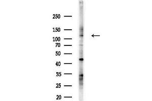 Western blot analysis of lysates from LoVo cells(heat-shock, 45 min treatment), using Slingshot homolog 1 Antibody at 1/1000 dilution.