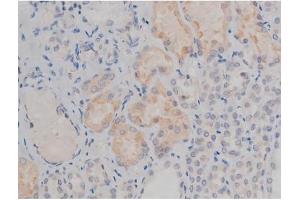 ABIN6267314 at 1/200 staining Human kidney tissue sections by IHC-P.