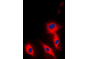 Immunofluorescent analysis of Ephrin A5 staining in Hela cells. (Ephrin A5 anticorps  (Center))
