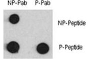 Dot blot analysis of phospho-MEF2C antibody and MEF2C nonphos pAb.