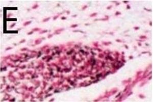 Potential migratory pathways for late neural crest cells and melanoblasts.