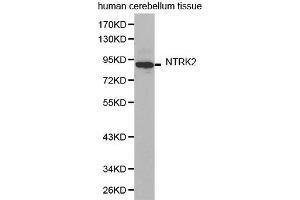 Western Blotting (WB) image for anti-Neurotrophic Tyrosine Kinase, Receptor, Type 2 (NTRK2) (AA 32-282) antibody (ABIN6219292) (TRKB anticorps  (AA 32-282))