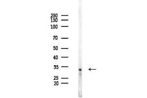 anti-Melanoma Antigen Family F, 1 (MAGEF1) (Internal Region) antibody