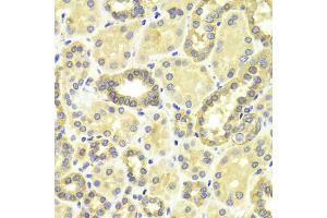 Immunohistochemistry of paraffin-embedded human kidney using MAP2K2 antibody. (MEK2 anticorps)