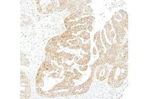 Immunohistochemistry (IHC) image for anti-Metadherin (MTDH) (AA 475-525) antibody (ABIN7795652)