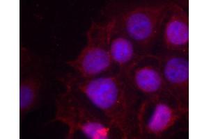 Immunofluorescence staining of methanol-fixed MCF cells using Phospho-ESR1-S118 antibody. (Estrogen Receptor alpha anticorps  (pSer118))