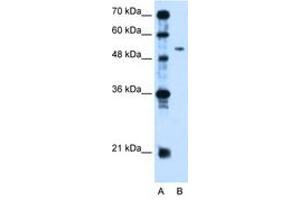 anti-Pregnancy Specific beta-1-Glycoprotein 1 (PSG1) (AA 96-145) antibody