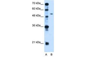 Image no. 1 for anti-Pregnancy Specific beta-1-Glycoprotein 1 (PSG1) (AA 96-145) antibody (ABIN204992) (PSG1 anticorps  (AA 96-145))