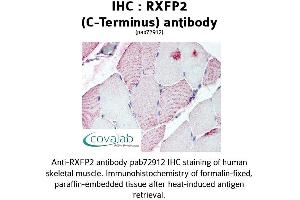 Image no. 1 for anti-Relaxin/insulin-Like Family Peptide Receptor 2 (RXFP2) (C-Term) antibody (ABIN1738987) (RXFP2 anticorps  (C-Term))