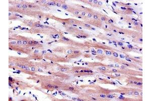 Immunohistochemistry of paraffin-embedded human heart tissue using ABIN7158887 at dilution of 1:100