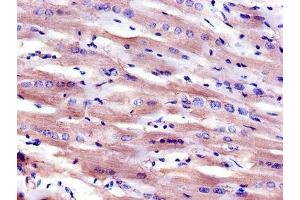 Immunohistochemistry of paraffin-embedded human heart tissue using ABIN7158887 at dilution of 1:100 (Macrophage Scavenger Receptor 1 anticorps  (AA 271-446))