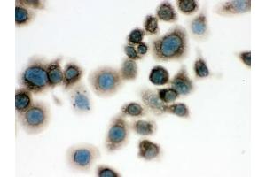 ICC testing of FFPE mouse Neuro-2a cells with TCP1 delta antibody. (CCT4 anticorps)