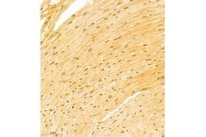 Immunohistochemistry of paraffin embedded mouse heart using ATF7 (ABIN7072916) at dilution of 1:800 (300x lens)