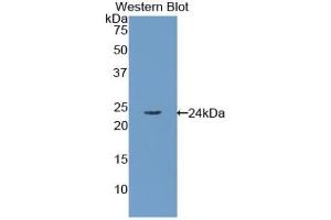 Detection of Recombinant RBP4, Human using Polyclonal Antibody to Retinol Binding Protein 4 (RBP4) (RBP4 anticorps)