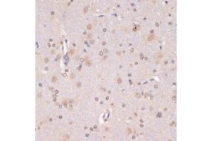 Immunohistochemistry of paraffin-embedded rat brain using PIDD antibody (ABIN1680710, ABIN3019230, ABIN3019231, ABIN5664897 and ABIN6220775) at dilution of 1:100 (40x lens). (PIDD anticorps  (AA 1-85))