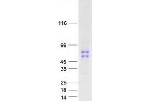Validation with Western Blot