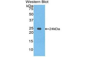 Western Blotting (WB) image for anti-Spondin 1 (SPON1) (AA 608-802) antibody (ABIN1860615) (SPON1 anticorps  (AA 608-802))