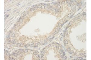 Immunohistochemistry (IHC) image for anti-BCL2-Associated Agonist of Cell Death (BAD) (AA 1-50) antibody (ABIN7448932) (BAD anticorps  (AA 1-50))