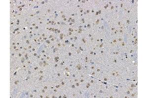 ABIN7094994 and ABIN7099050 at 1/100 staining rat brain tissue by IHC-P. (RNF114 anticorps)