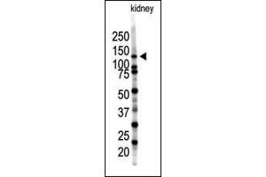 Western blot analysis of SENP7 polyclonal antibody (ABIN388053 and ABIN2845652) in mouse kidney tissue lysate (35 μg/lane). (SENP7 anticorps  (C-Term))