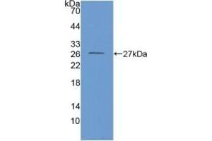 Detection of Recombinant GDH, Mouse using Polyclonal Antibody to Glutamate Dehydrogenase 1 (GLUD1) (GLUD1 anticorps  (AA 65-273))
