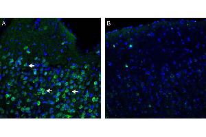 Expression of Orai1 in rat parietal cortex. (ORAI1 anticorps  (2nd Extracellular Loop))