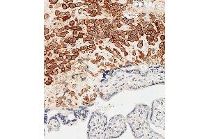 Immunohistochemical analysis of paraffin-embedded Human placenta tissue using (ABIN652888 and ABIN2842575) performed on the Leica® BOND RXm. (HLAG anticorps  (AA 62-89))