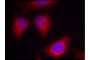 Image no. 2 for anti-Protein Kinase C, theta (PRKCQ) (AA 674-678) antibody (ABIN197566) (PKC theta anticorps  (AA 674-678))