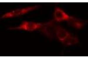 ABIN6277566 staining HeLa cells by IF/ICC. (EEF2K anticorps  (Internal Region))
