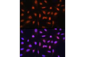 Immunofluorescence analysis of U-2 OS cells using GTF2H1 Rabbit pAb (ABIN6131728, ABIN6141498, ABIN6141499 and ABIN6222557) at dilution of 1:100 (40x lens). (GTF2H1 anticorps  (AA 1-425))