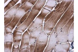 IHC-P Image TIP30 antibody detects TIP30 protein at cytoplasm in mouse muscle by immunohistochemical analysis.