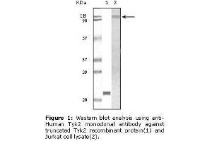 Image no. 1 for anti-Tyrosine Kinase 2 (TYK2) antibody (ABIN232114) (TYK2 anticorps)