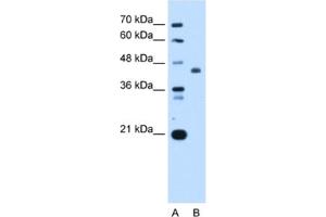 Western Blotting (WB) image for anti-ST3 beta-Galactoside alpha-2,3-Sialyltransferase 4 (ST3GAL4) antibody (ABIN2462999) (ST3GAL4 anticorps)