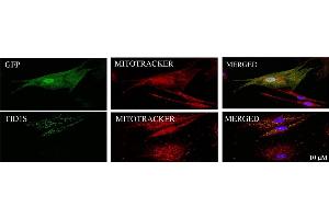 Human skin fibroblasts from healthy individuals were transduced with lentivirus carrying pH AGE-TID1S gene or vector control for 5 days prior to staining vector control with an anti-GFP antibody (cat.