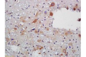 Formalin-fixed and paraffin embedded rat brain labeled with Rabbit Anti-VAT Polyclonal Antibody, Unconjugated (ABIN735113) at 1:200 followed by conjugation to the secondary antibody and DAB staining (SLC18A3 anticorps  (AA 201-300))