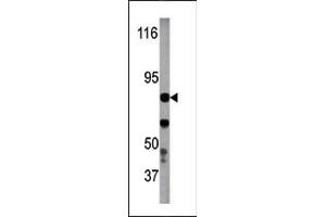 The anti-Phospho-IKKb- Pab (ABIN389574 and ABIN2839600) is used in Western blot to detect Phospho-IKKb- in Y79 tissue lysate