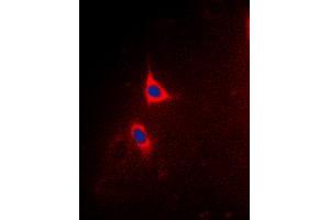 Immunofluorescent analysis of BCLX (pT47) staining in Hela cells.