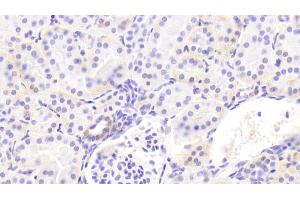 anti-Integrin alpha 2 (ITGA2) (AA 170-361) antibody