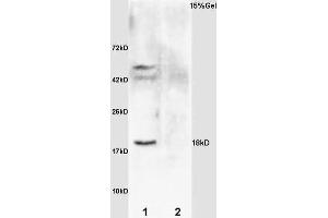 L1 rat brain lysates L2 rat kidney lysates probed with Anti IL-2R gamma/CD132 Polyclonal Antibody, Unconjugated (ABIN685432) at 1:200 overnight at 4 °C. (GADD45A anticorps  (AA 65-165))
