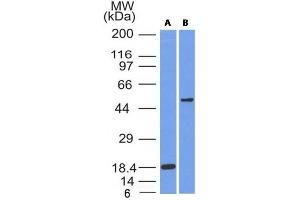 Western Blot Analysis of SOX10 (A) Recombinant protein (B) A375 cell lysate using SOX10 Mouse Monoclonal Antibody (SOX10/991).