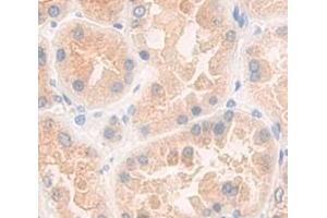 IHC-P analysis of Human Tissue, with DAB staining. (SOCS3 anticorps  (AA 1-225))