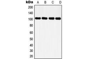 Western blot analysis of Histone Deacetylase 7 expression in HeLa (A), NIH3T3 (B), PC12 (C), rat kidney (D) whole cell lysates.